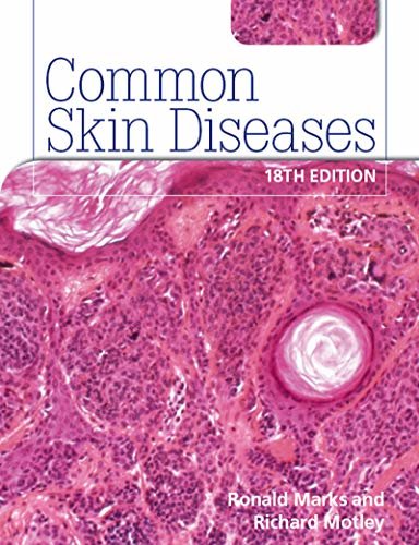 Common Skin Diseases 18th edition: ISE Version (English Edition)