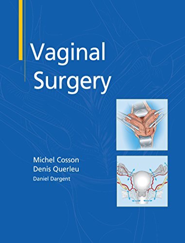Vaginal Surgery (English Edition)