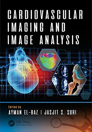 Cardiovascular Imaging and Image Analysis (3D Photorealistic Rendering) (English Edition)