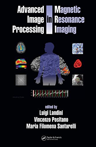 Advanced Image Processing in Magnetic Resonance Imaging (Signal Processing and Communications Book 27) (English Edition)