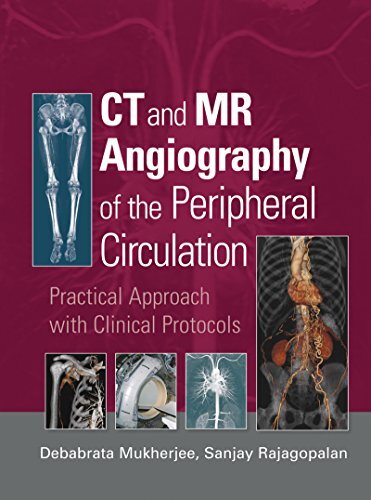 CT and MR Angiography of the Peripheral Circulation: Practical Approach with Clinical Protocols (English Edition)