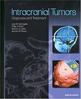 Intracranial Tumors: Diagnosis and Treatment (English Edition)