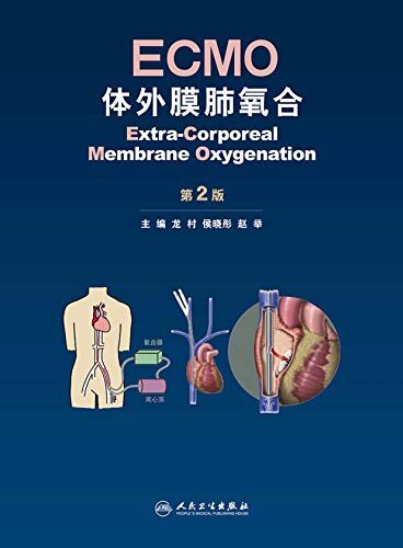 ECMO——体外膜肺氧合（第2版）