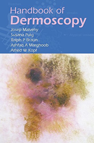 Handbook of Dermoscopy (English Edition)