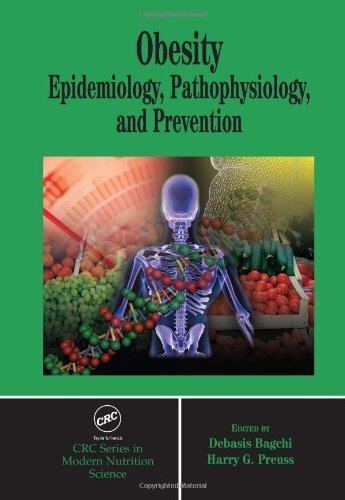 Obesity: Epidemiology, Pathophysiology, and Prevention (CRC Press series in Modern Nutrition Science) (English Edition)