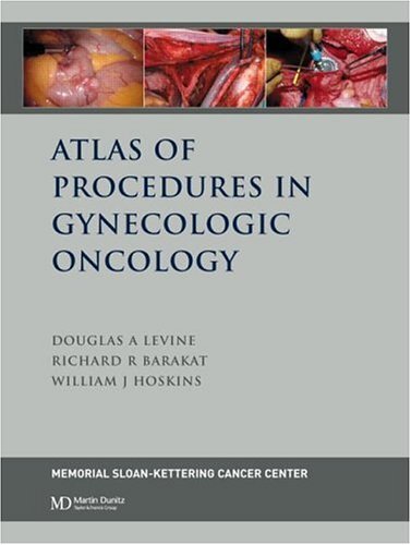 Atlas of Procedures in Gynecologic Oncology (English Edition)