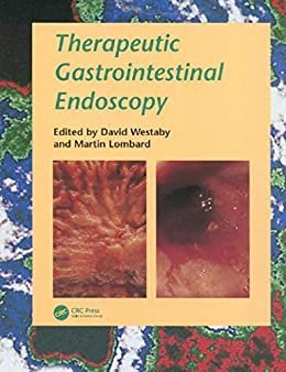 Therapeutic Gastrointestinal Endoscopy (English Edition)