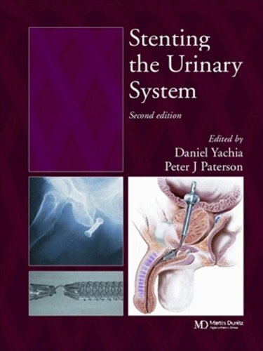 Stenting the Urinary System (English Edition)