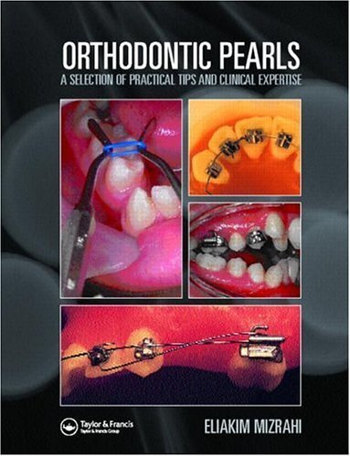 Orthodontic Pearls (English Edition)