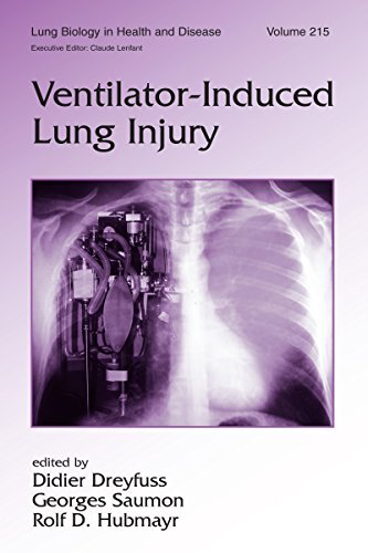 Ventilator-Induced Lung Injury (Lung Biology in Health and Disease Book 215) (English Edition)