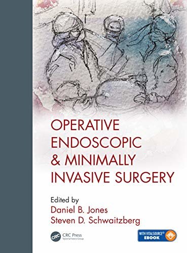 Operative Endoscopic and Minimally Invasive Surgery (English Edition)