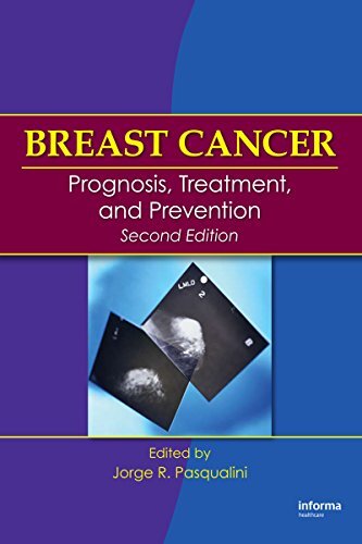 Breast Cancer: Prognosis, Treatment, and Prevention (English Edition)