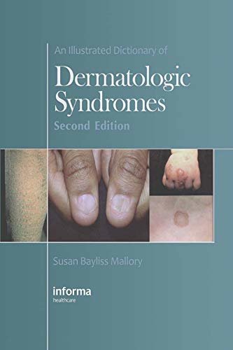 An Illustrated Dictionary of Dermatologic Syndromes (English Edition)