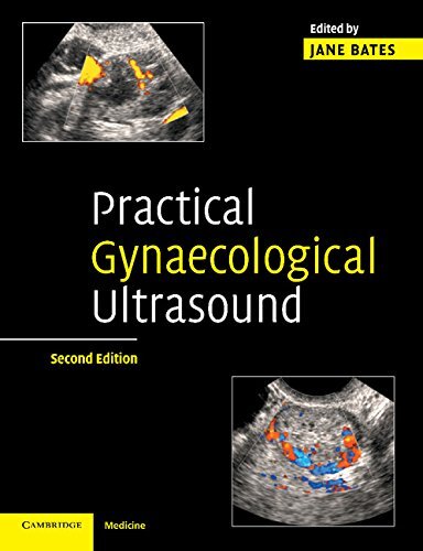 Practical Gynaecological Ultrasound (English Edition)