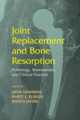 Joint Replacement and Bone Resorption: Pathology, Biomaterials and Clinical Practice (English Edition)