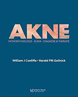 Acne: Diagnose und Therapie (German Edition)