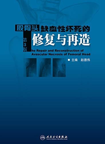 股骨头缺血性坏死的修复与再造