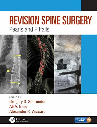 Revision Spine Surgery: Pearls and Pitfalls (English Edition)