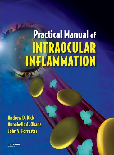 Practical Manual of Intraocular Inflammation (English Edition)