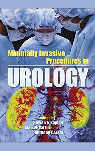Minimally Invasive Procedures in Urology (English Edition)