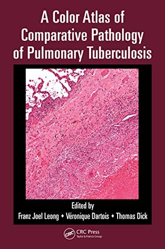 A Color Atlas of Comparative Pathology of Pulmonary Tuberculosis (English Edition)