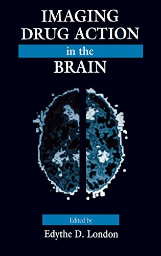 Imaging Drug Action in the Brain (English Edition)
